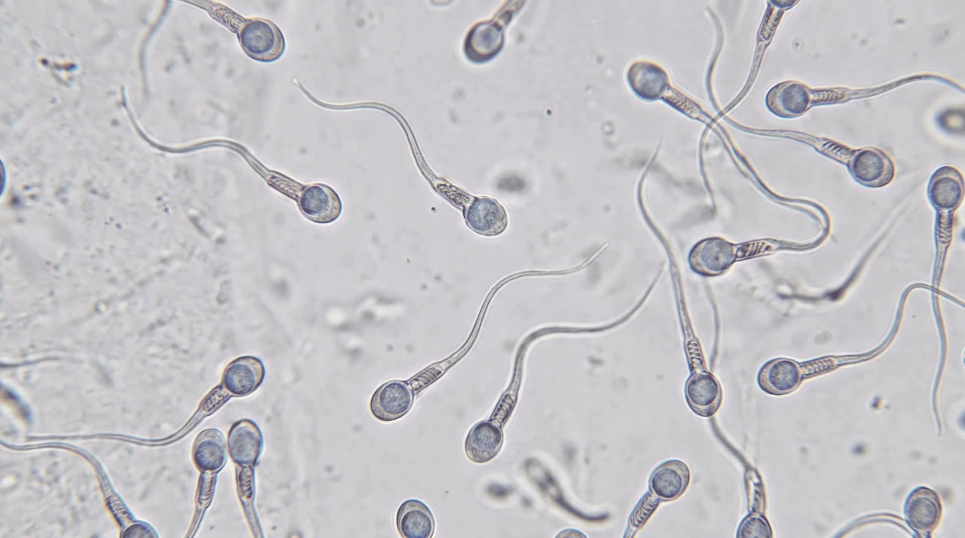 Personalized Precision Treatment for Azoospermia