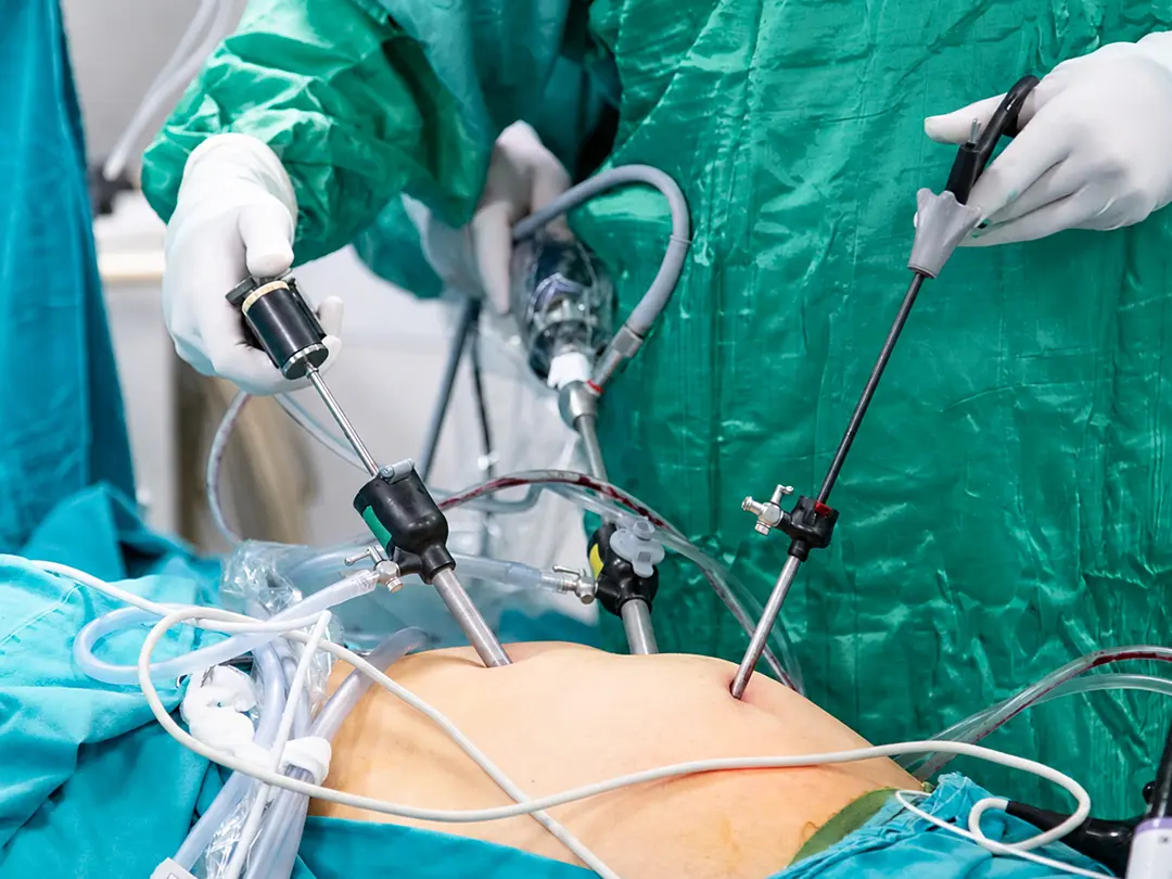 Gynecologic Minimally Invasive Surgery