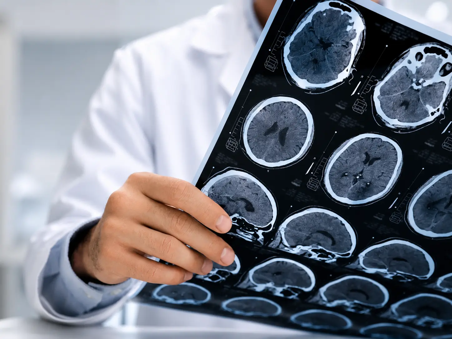 Molecular Imaging for Dementia & Parkinson