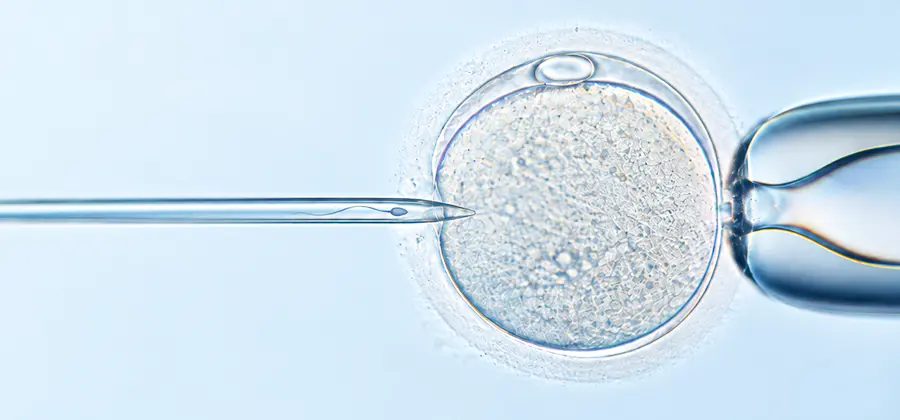Assisted Reproduction for Infertility