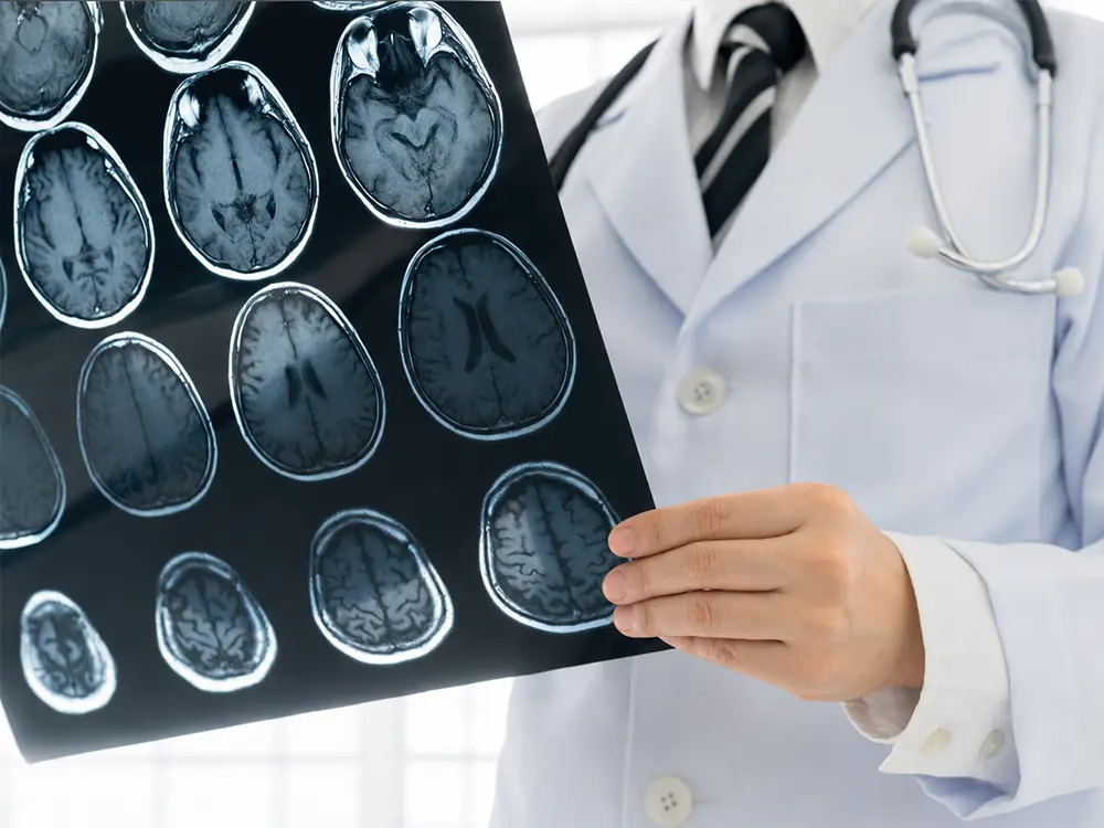 Establishing a Seamless Stroke Network
