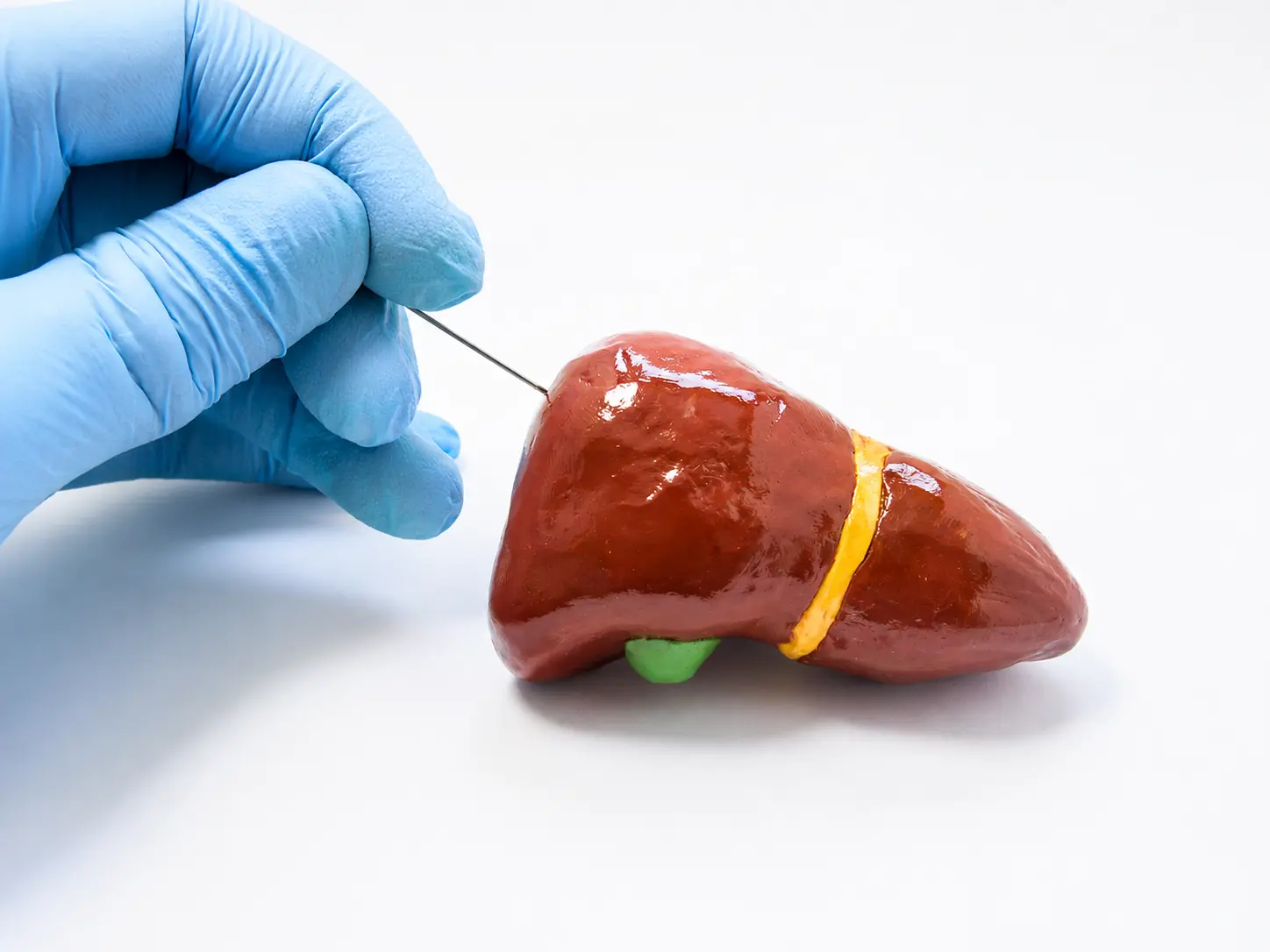 Liver Transplant Laboratory Service