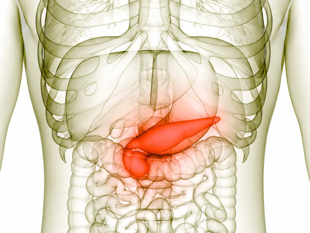 Pancreas Transplant for Diabetes