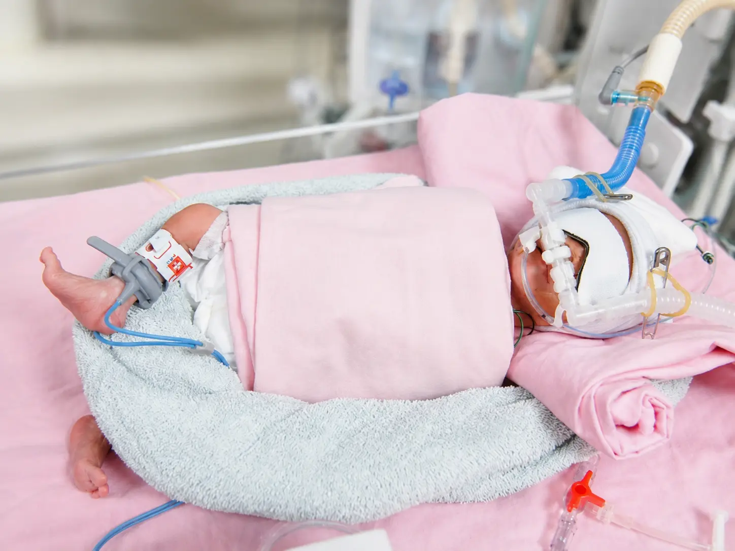 Neonatal & Pediatric Respiratory Care