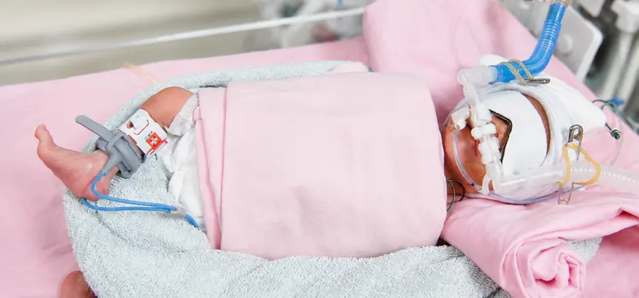 新生兒、兒童呼吸治療