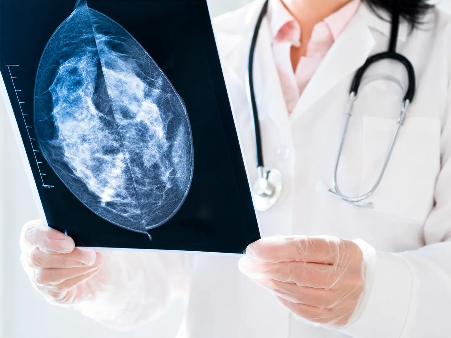 Integrated breast Cancer Clinic Service