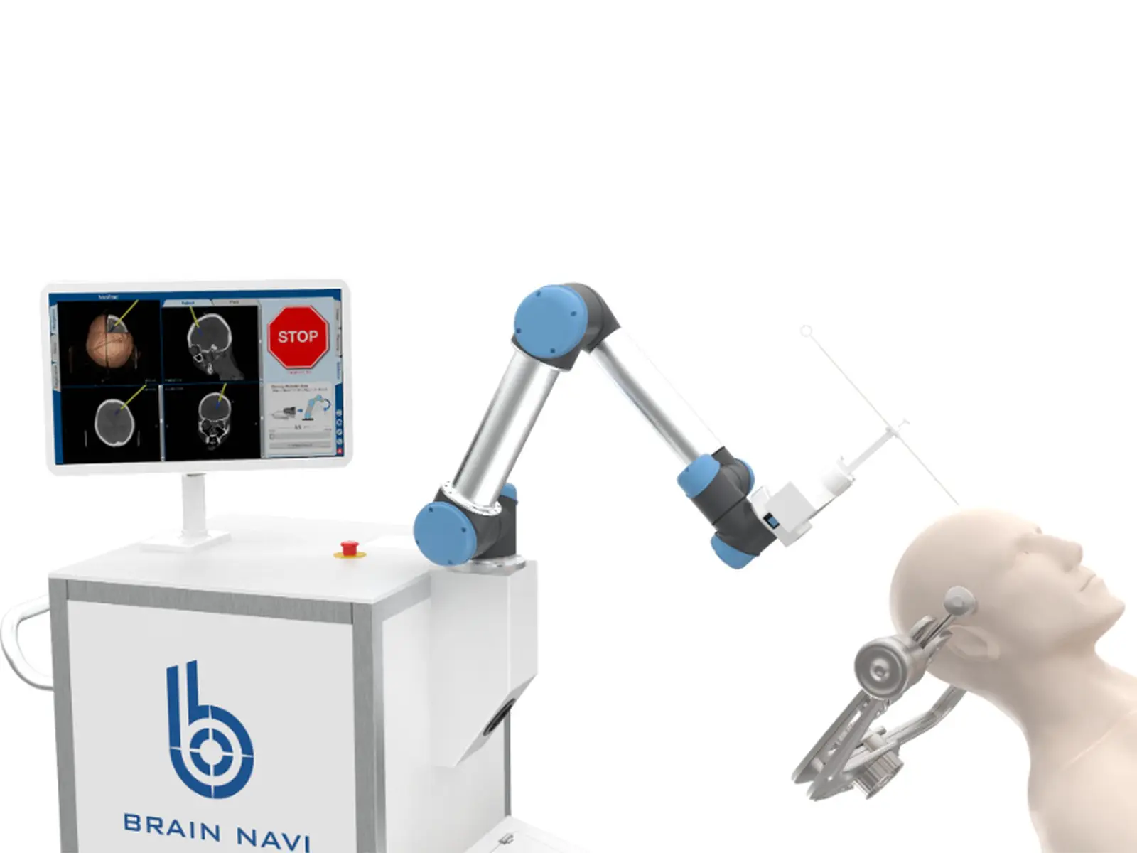 Brain Navi Navigation System for Brain Surgery