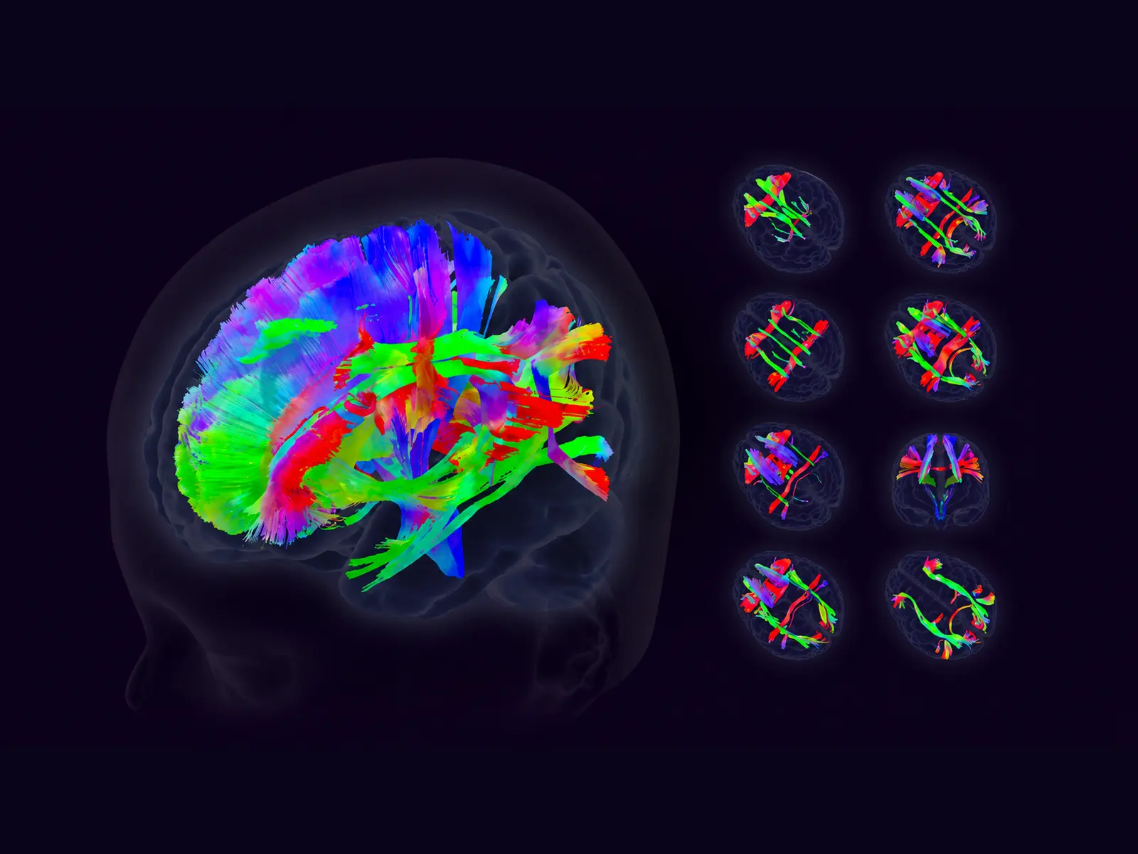 Axonal Brain Age – Brain Health Report