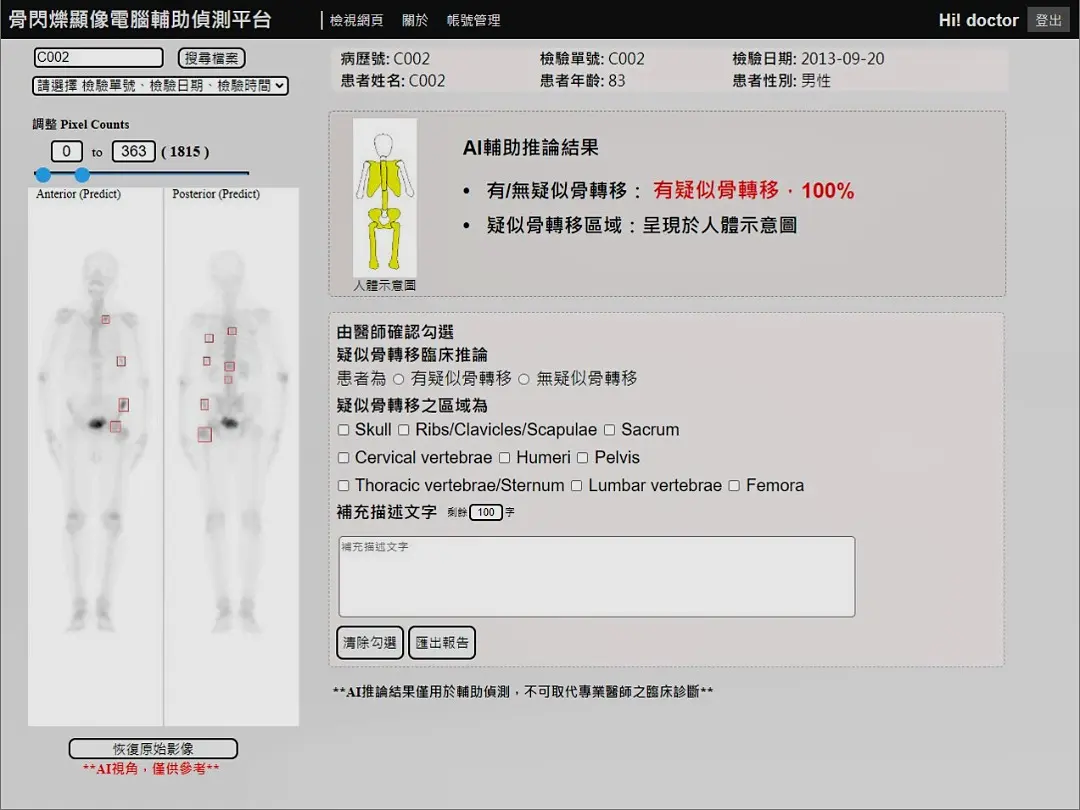 核子醫學骨掃描人工智慧平台