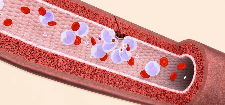 Far-Infrared Therapy for Dialysis Vascular Access