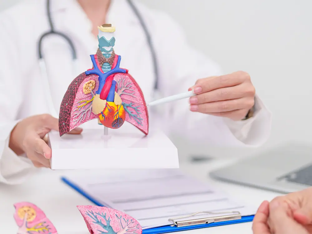 Holistic Care for Drug-Resistant TB