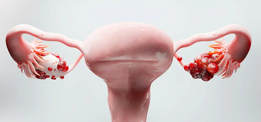 婦科癌症