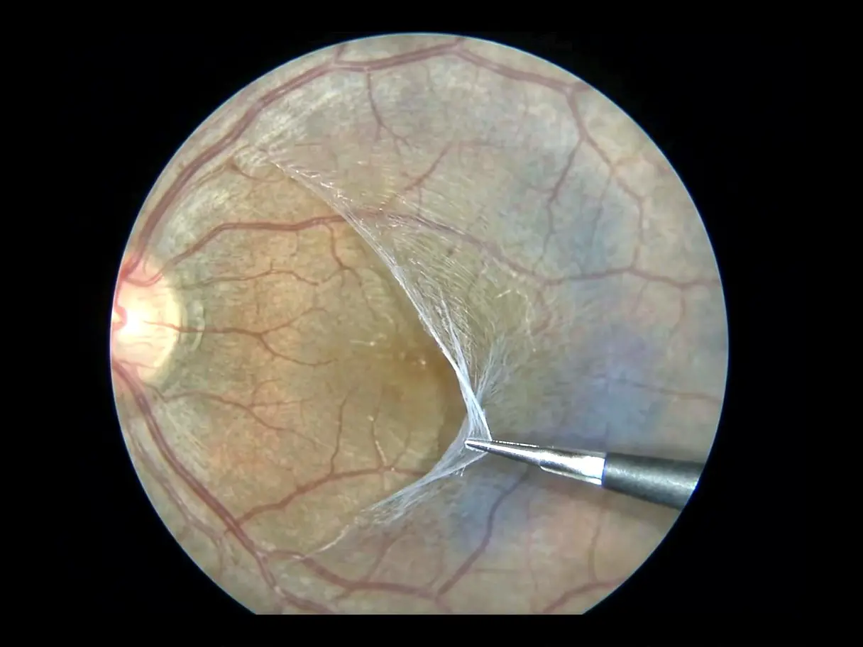 Macular Disease Diagnosis & Treatment
