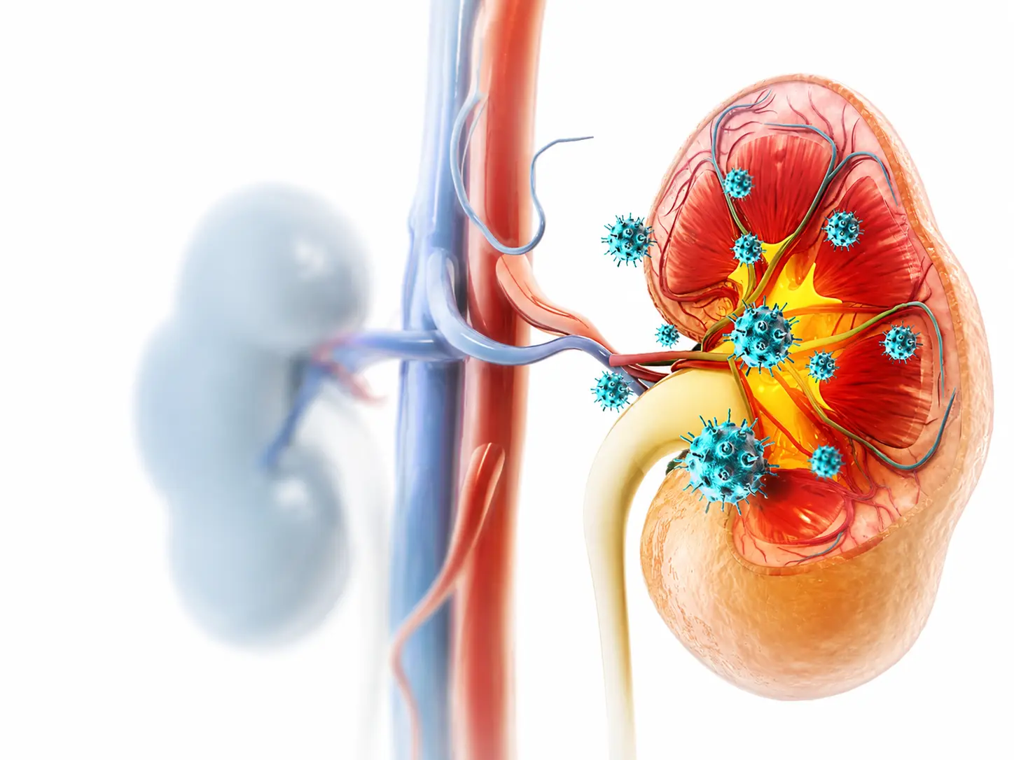 Pharmacist-led kidney care network