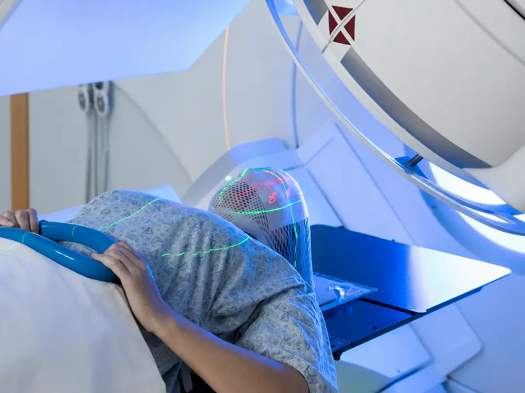 Integrated Care for Head & Neck Cancer RT