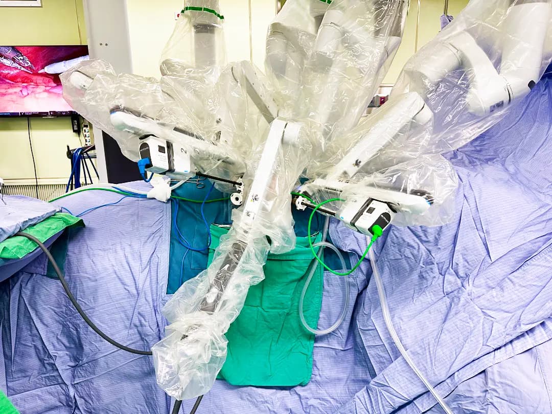 局部晚期攝護腺癌根除手術