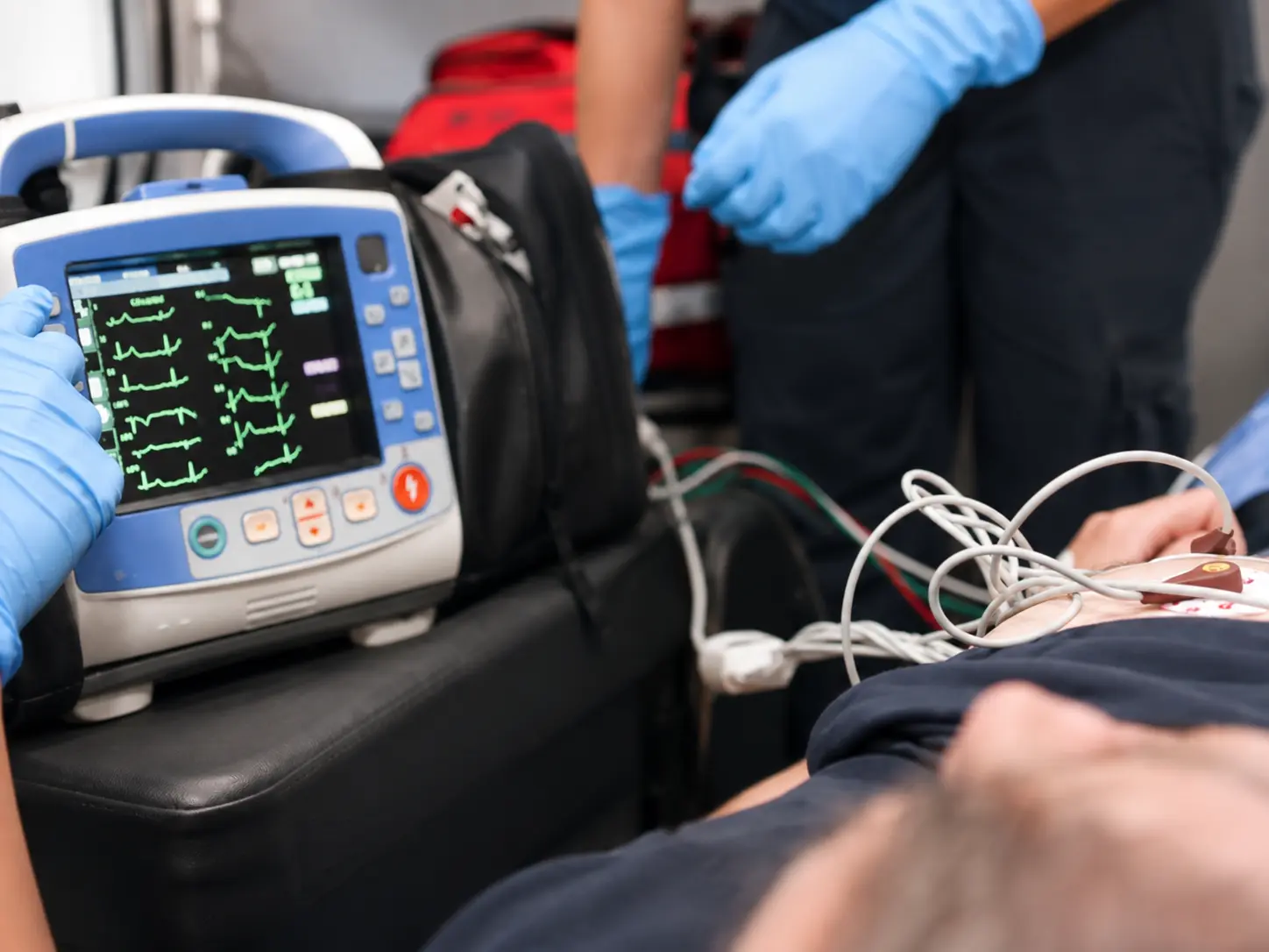 AI-ECG Reducing Mortality