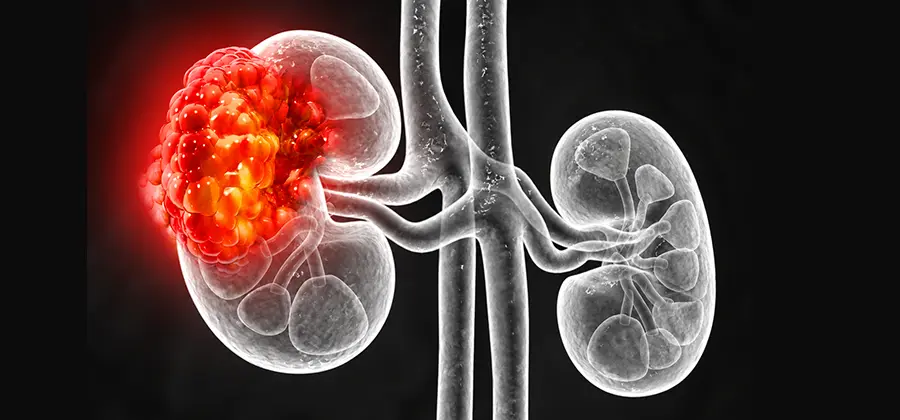 Net Zero Kidney Care
