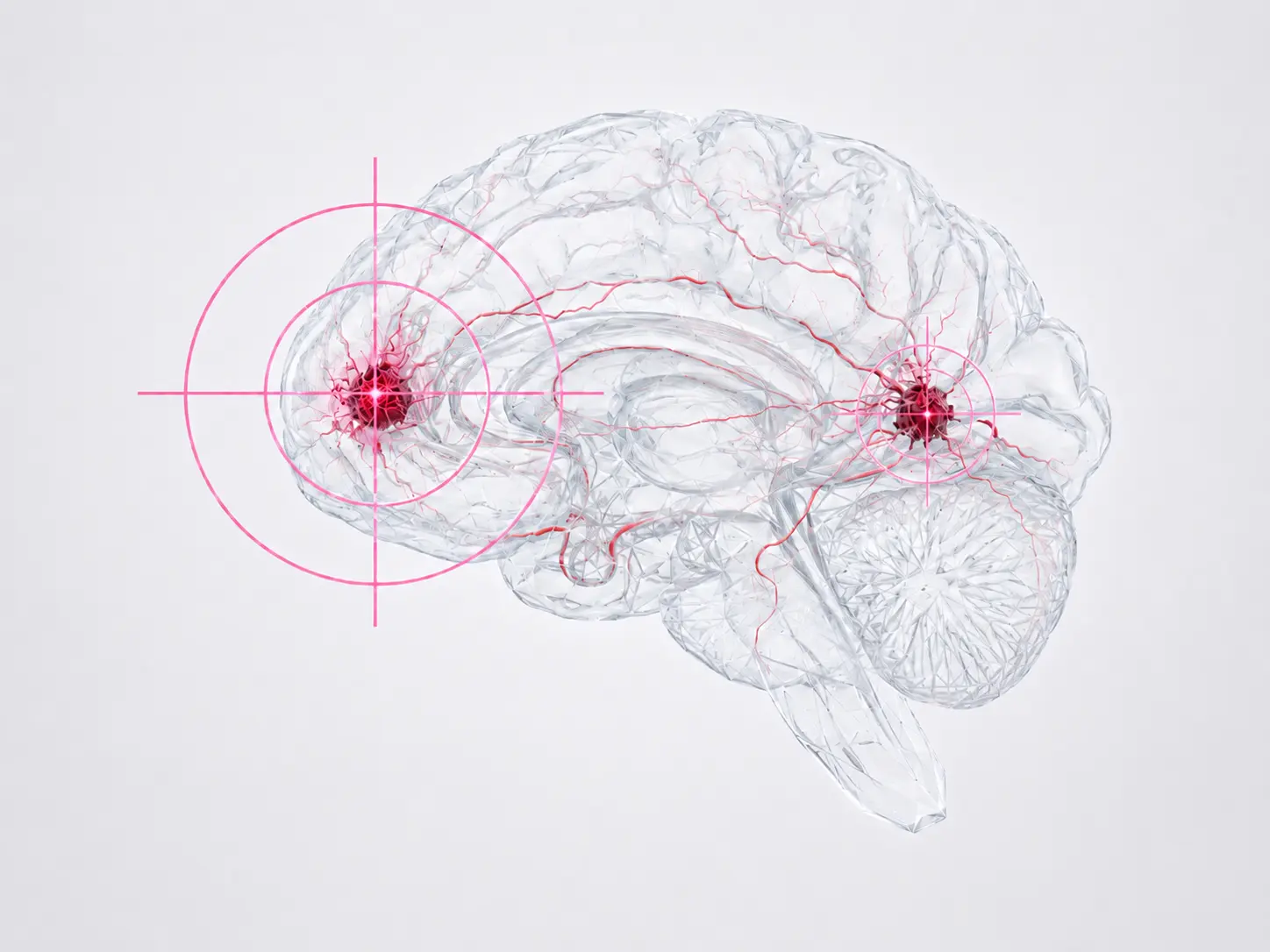 BNCT for Malignant Brain Tumors