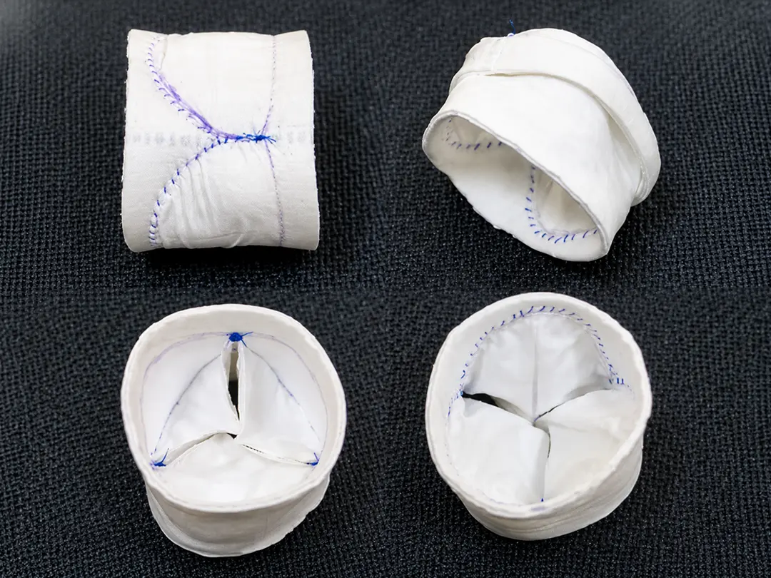 Surgical PVR for rToFwith RV failure