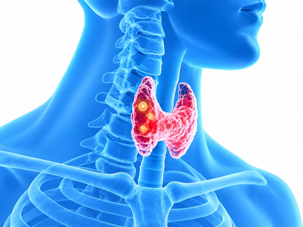 Minimally Invasive Thyroid Tumor Treatment