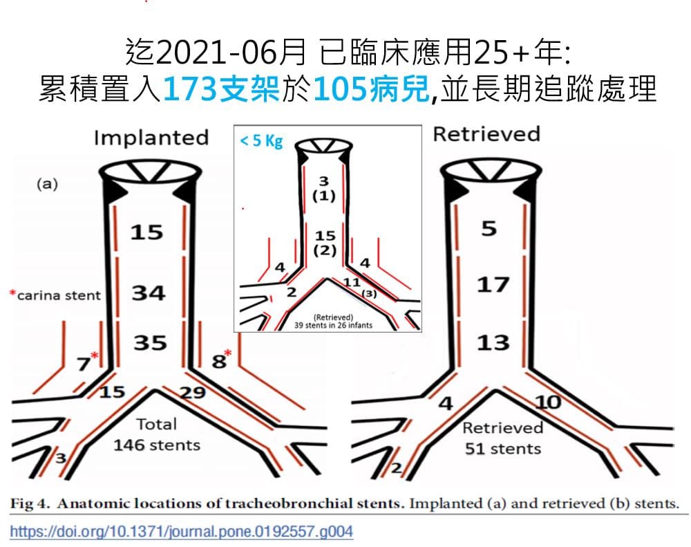 Song's Simple Resuscitative Ventilation