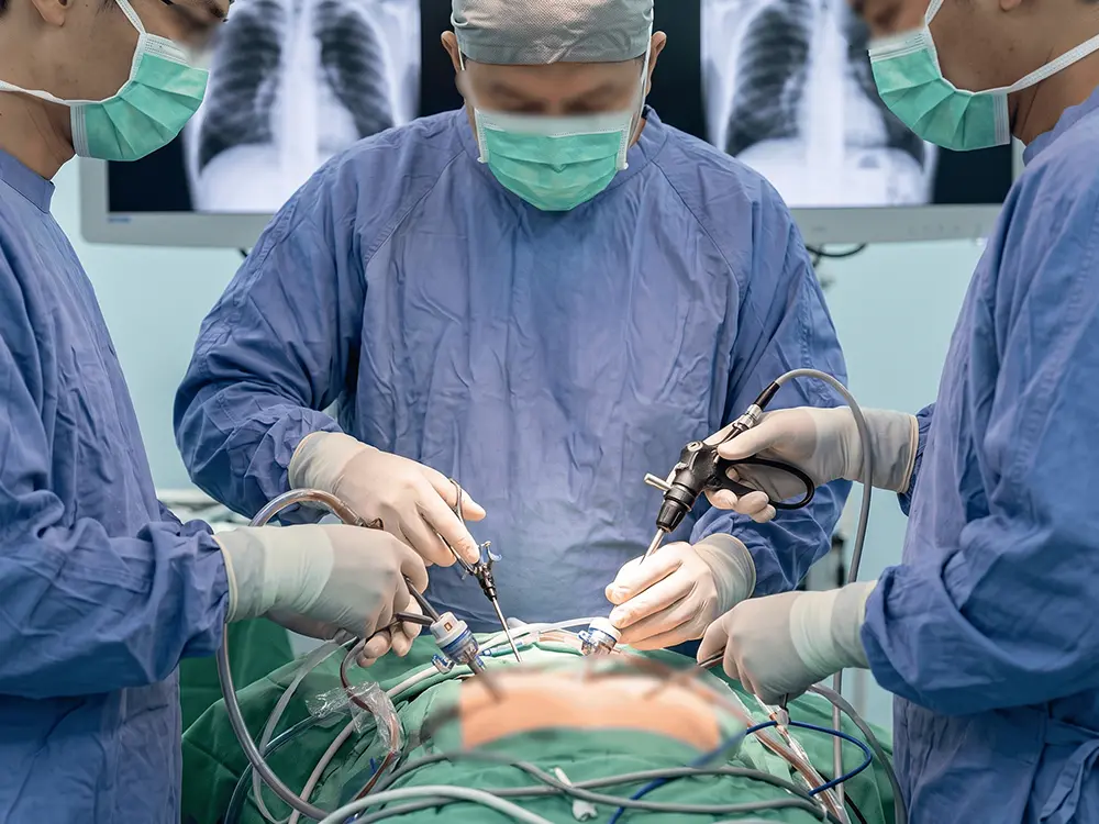 MIS for Thoracic Trauma & Rib Fracture