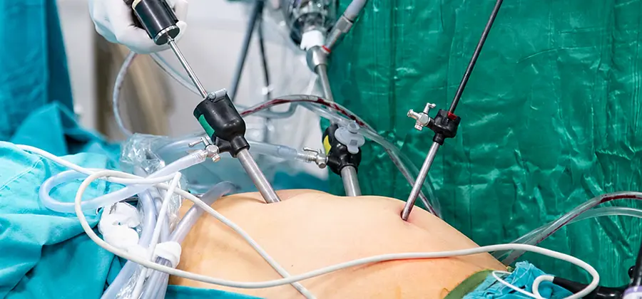 Gynecologic Minimally Invasive Surgery