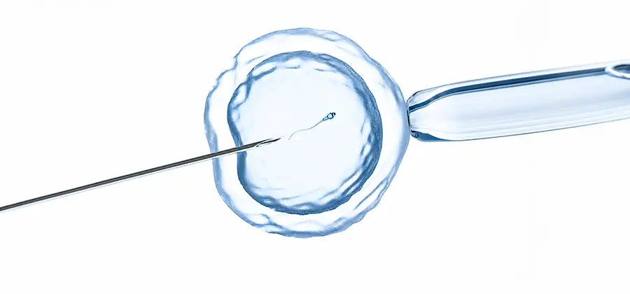 Assisted Reproduction for Infertility
