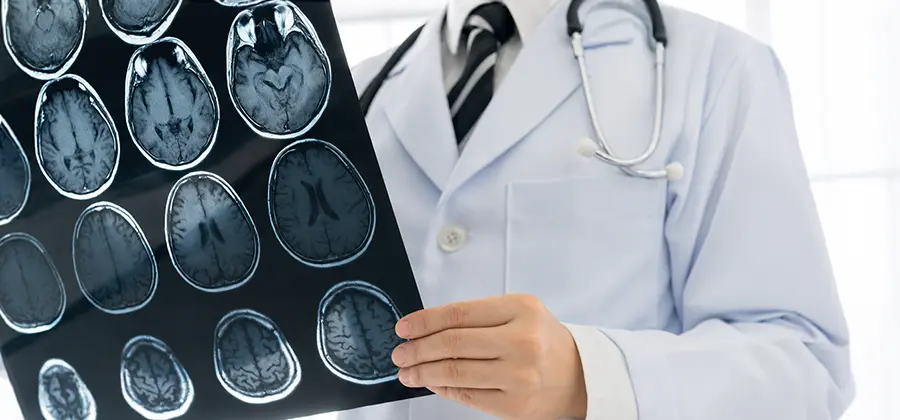 Establishing a Seamless Stroke Network