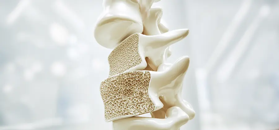 Non-Profit Hospital Bone Bank