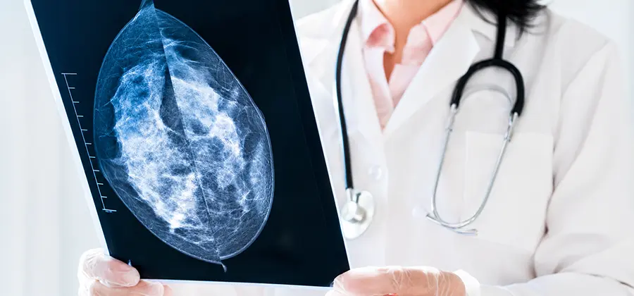 Integrated breast Cancer Clinic Service