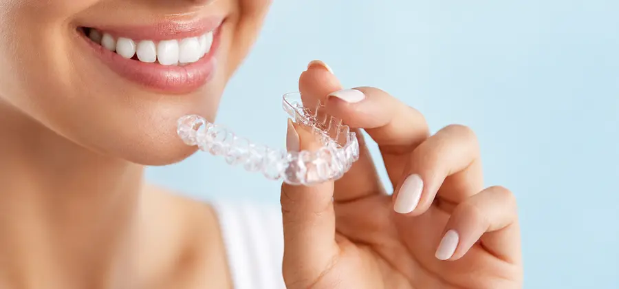 “SmileAlign” Orthodontic Aligner System