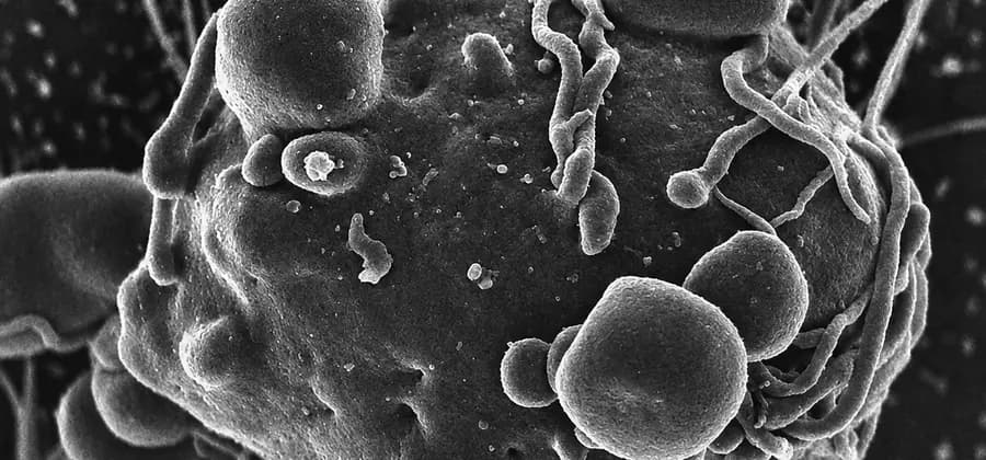 Rapid Testing & Treatment for Leptospirosis