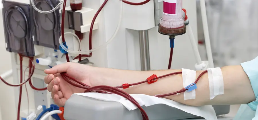 AI Prediction Intradialytic Hypotension