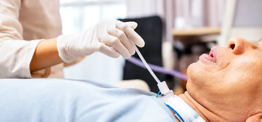 Integrated Tube Removal Care