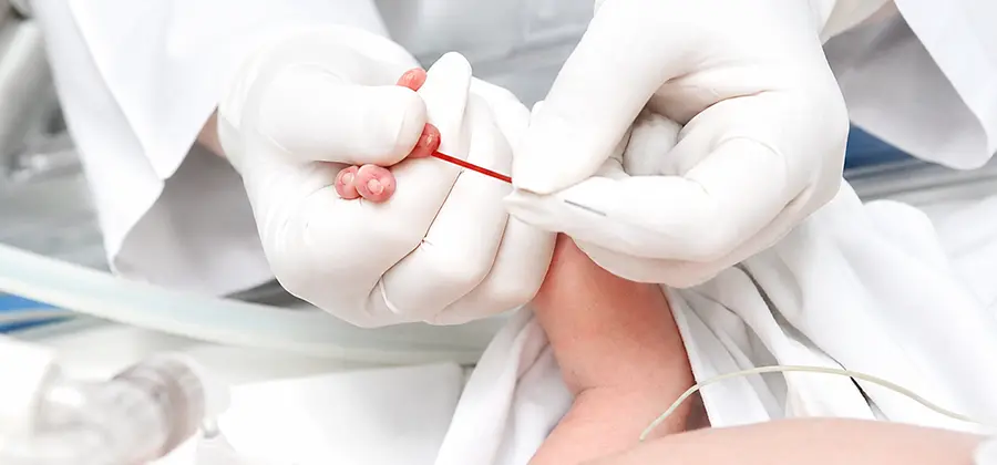 Mucopolysaccharidosis