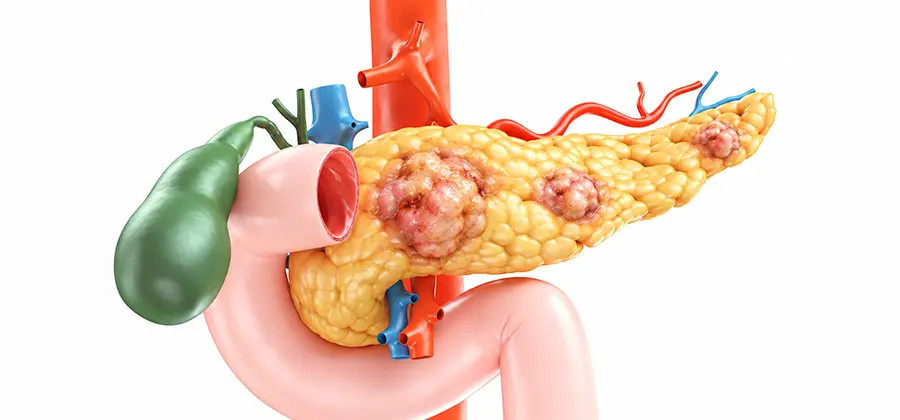 Comprehensive Pancreatic Care & Training