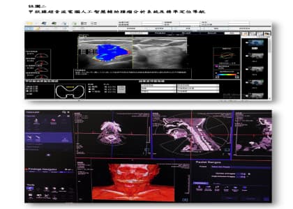 Establishing comprehensive cardiovascular care in outlying islands