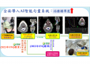 頭頸癌的AI精準放射治療